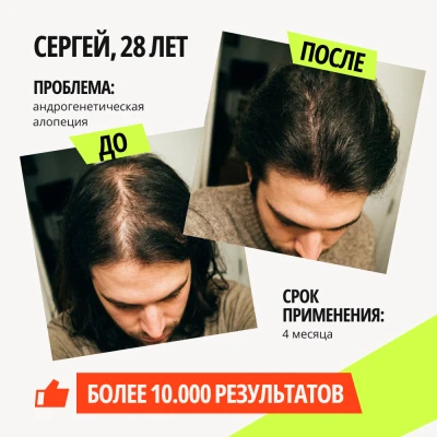 Лосьон для роста волос iiSolutions 15% - 6 флаконов - фото 3