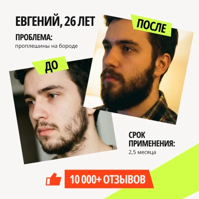Лосьон для роста волос XILNOXIN 15% - 6 флаконов - фото 5