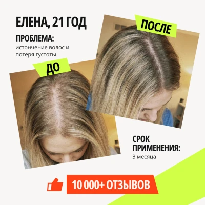 Лосьон для роста волос XILNOXIN 5% - 3 флакона - фото 5